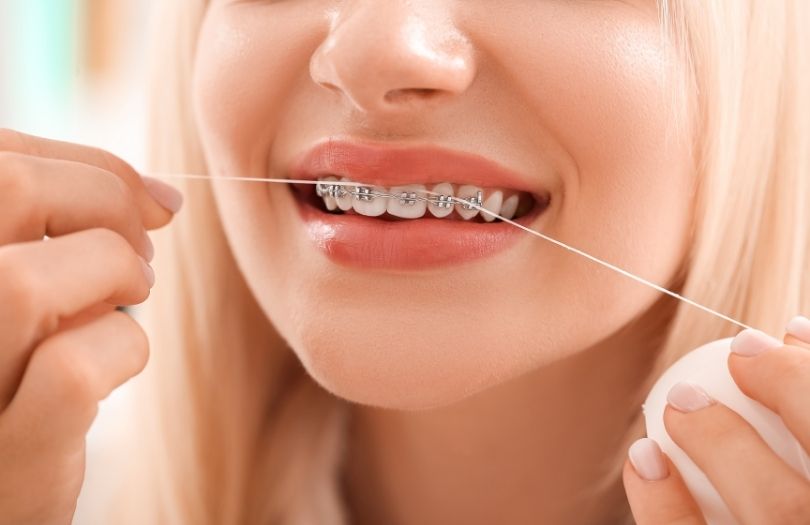 Dr ozlem aylikci ortodonti uzmani seffaf plak uzmani invisalign uzmani Bahadir ugur aylikci dis ipi kullanimi braketlerde ip kullanimi