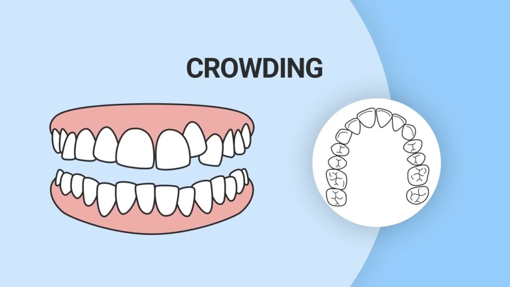 Ortodontik Problemleri Nasıl Anlarız? 1 Ortodontik problemleri nasıl anlarız