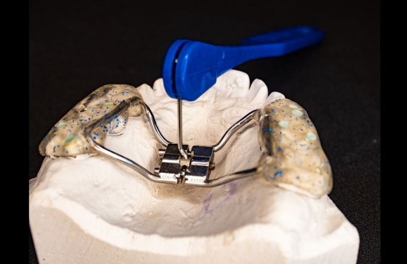 Invisalign First nedir? 6 Dr. Ozlem Aylikci Drozlemorto Gulus Tasarim Uzmani dr. Bahadir Ugur Aylikci Maksilller expansiyon apareyi