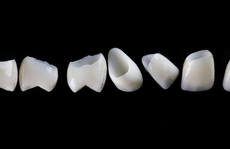Zirkonyum Kaplamalar 17 Dr. Ozlem Aylikci Drozlemorto Gulus Tasarim Uzmani dr. Bahadir Ugur Aylikci Zirkonyum Veneer Zirkonyum Kaplama tek tek 2 1