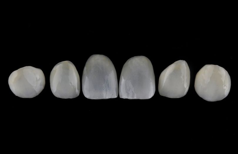 Zirkonyum Kaplamalar 11 Dr. Ozlem Aylikci Drozlemorto Gulus Tasarim Uzmani dr. Bahadir Ugur Aylikci Zirkonyum Veneer Zirkonyum Kaplama tek tek