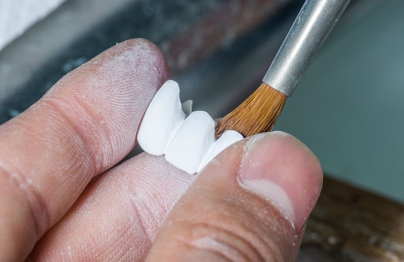 Zirkonyum Kaplamalar 5 Dr. Ozlem Aylikci Drozlemorto Gulus Tasarim Uzmani dr. Bahadir Ugur Aylikci Zirkonyum Veneer Zirkonyum zirkon alt yapi2