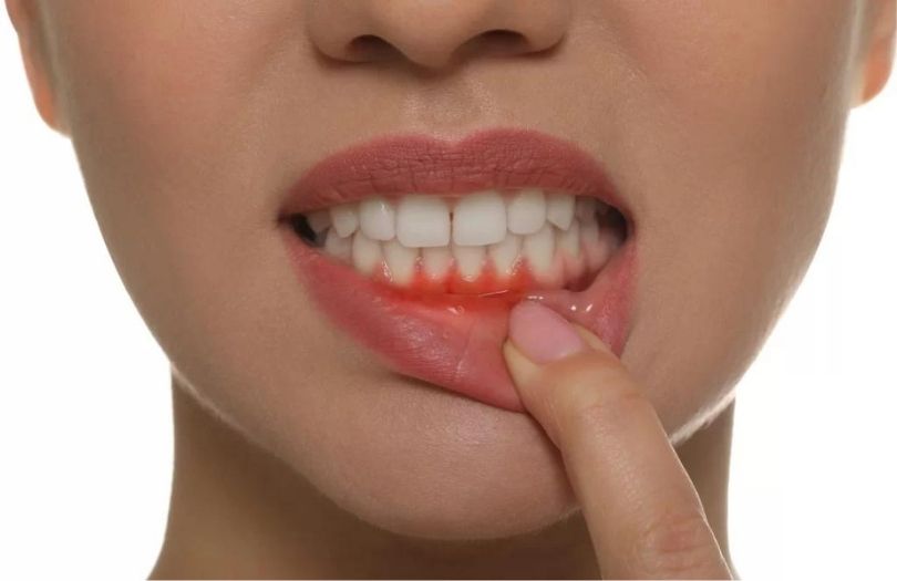 Pembe Estetik 2 Dr. ozlem aylikci Drozlemorto Gulus tasarim uzmani dr. Bahadir Ugur Aylikci Pembe Estetik Pink Esthetic Sislik