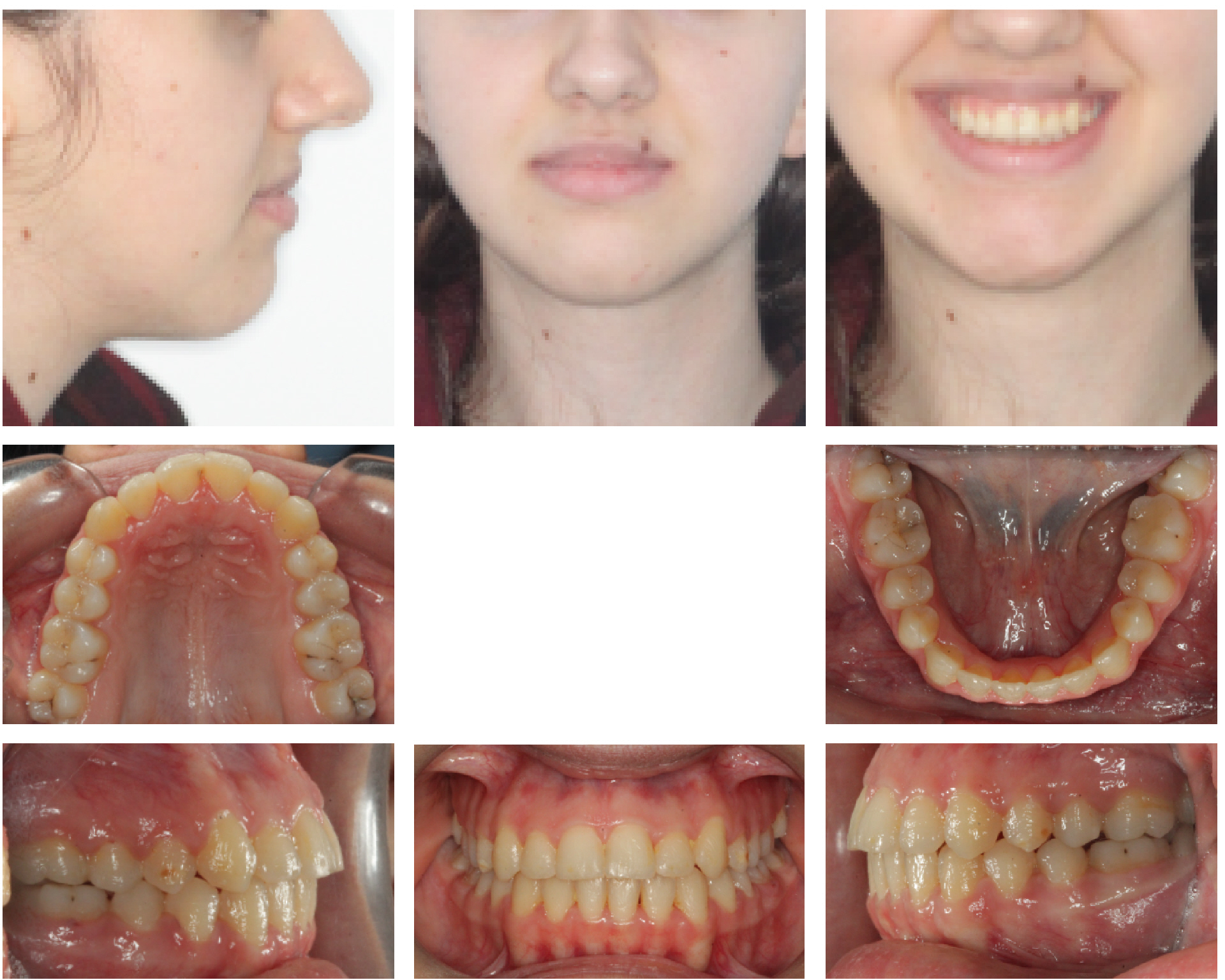 Ortodonti Uzmani Dr. Ozlem Aylikci 5 after