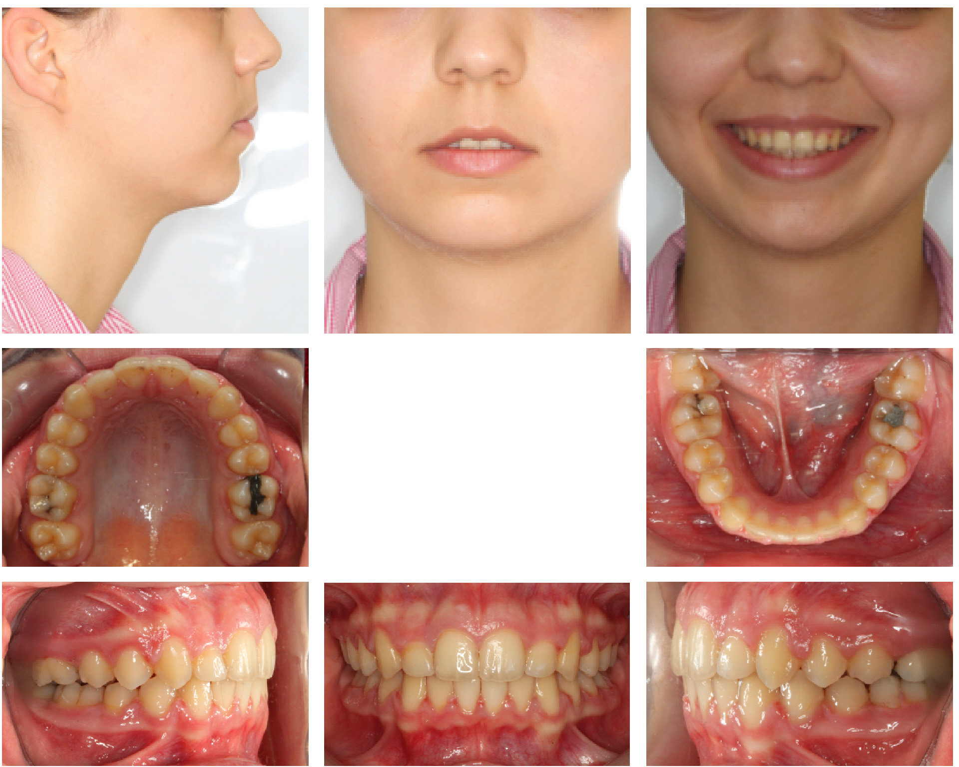 Ortodonti Uzmani Dr. Ozlem Aylikci 9 after