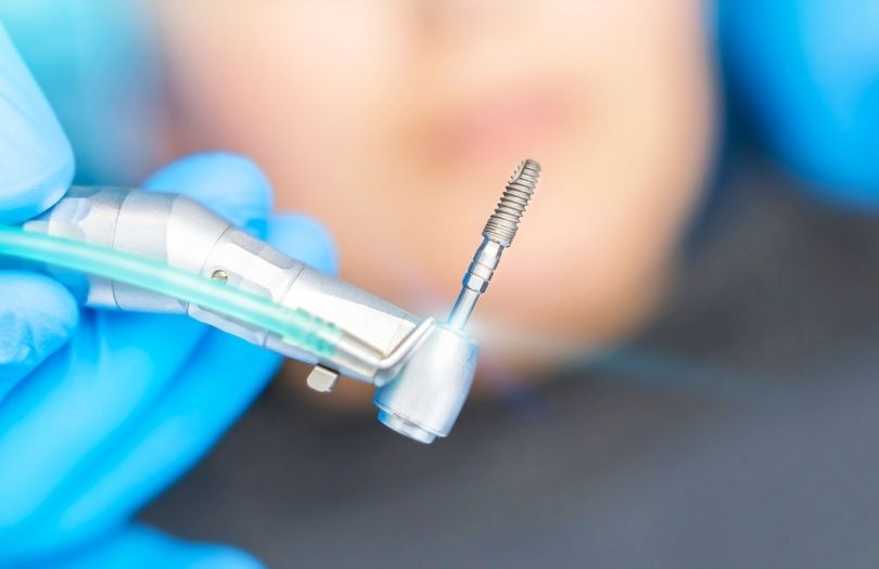Dental İmplant 1 yabancı implantlar implant fiyatları yerli implantlar