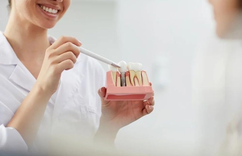 Dental İmplant 4 Dental implant implant markası tavsiye